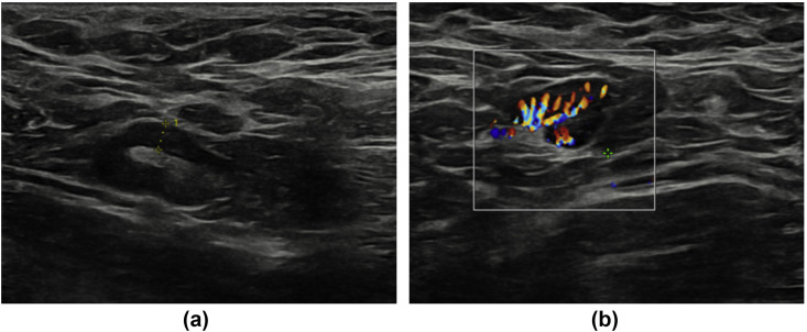 Figure 1