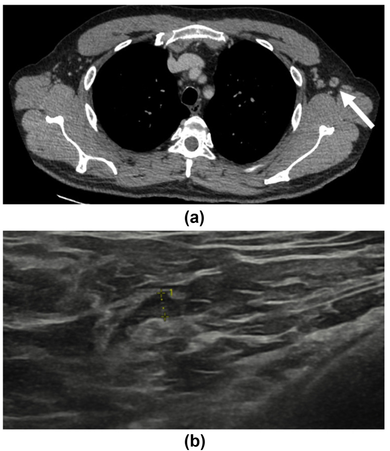 Figure 10