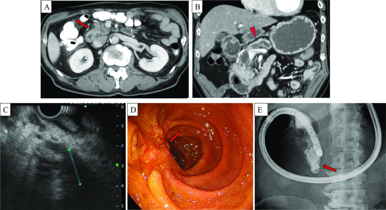 Fig. 1