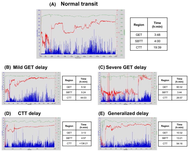 FIGURE 1