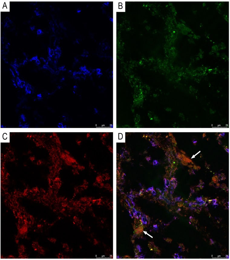 Figure 14