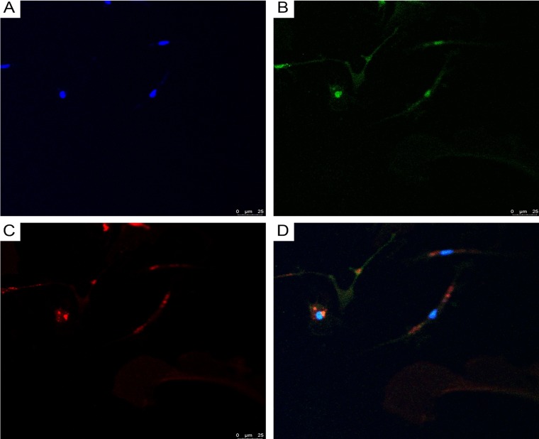 Figure 11