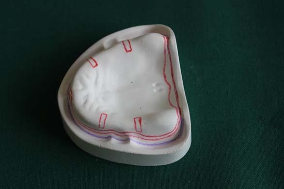 [Table/Fig-1]: