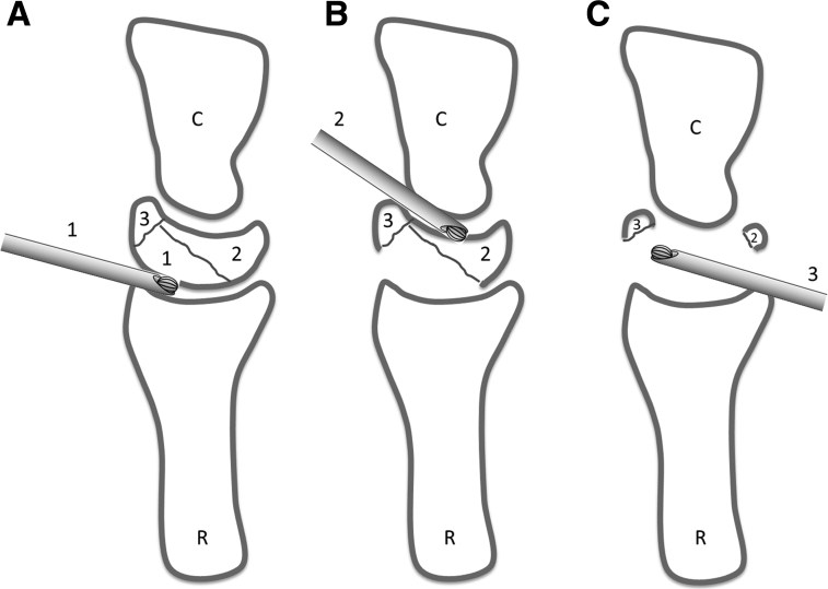 Fig 2