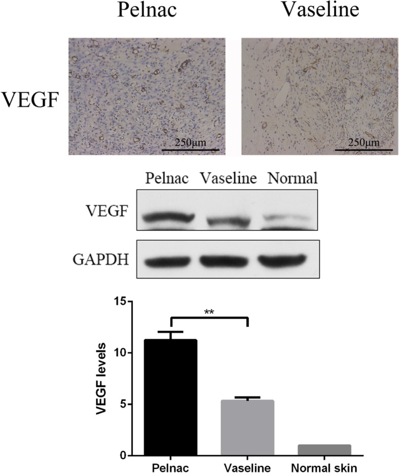 Fig. 13