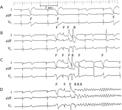 Figure 6: