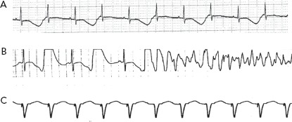 Figure 3: