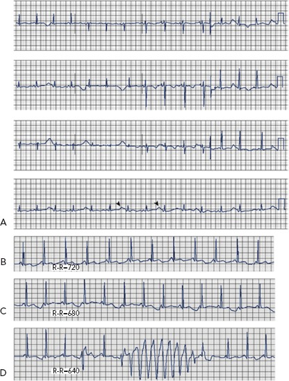 Figure 2: