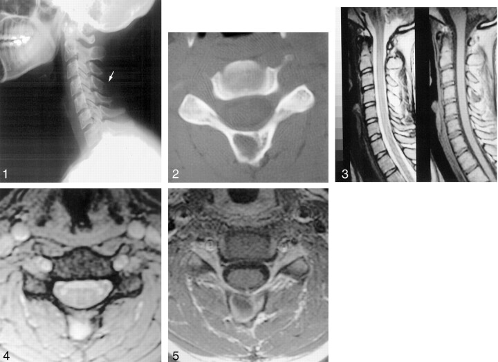 Fig 1.