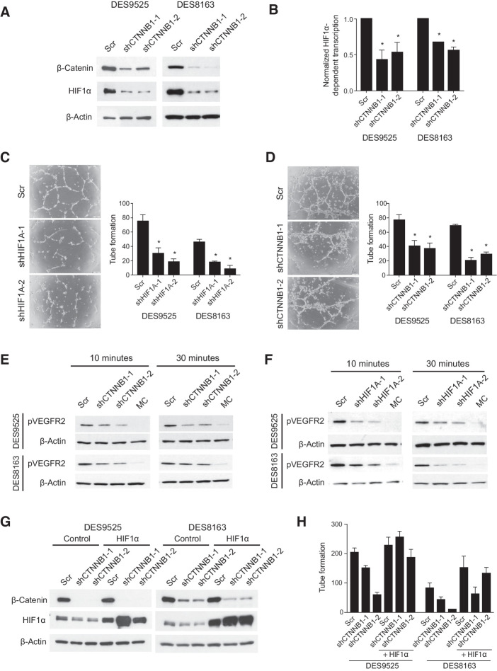 Figure 1. Desmoid cells promote endothelial cell tube formation by activating VEGFR2 in a HIF1A- and CTNNB1-dependent manner. A and B, Effect of CTNNB1 knockdown on (A) HIF1α protein and (B) mRNA expression assessed by dual luciferase assay. C and D, Effect of knockdown of (C) HIF1A or (D) CTNNB1 in DES9525 or DES8163 desmoid cells on co-culture–induced HUVEC tube formation. Representative photos show HUVECs following co-culture with DES9525 cells transduced as indicated; quantitated results average triplicate experiments. E and F, Effect of knockdown of (E) CTNNB1 or (F) HIF1A in desmoid cells on phosphorylation of VEGFR2 in HUVEC cells treated with desmoid-conditioned media for the indicated times; MC indicates nonconditioned media control. G and H, Effect of HIF1α overexpression on (G) HIF1α protein expression and (H) representative trial of co-culture–induced HUVEC tube formation in desmoid cells in which CTNNB1 is knocked down. Control for HIF1α overexpression is red fluorescent protein (RFP, Ctrl; *, P < 0.05).