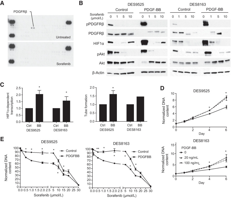 Figure 3. PDGF signaling is a sorafenib target that regulates HIF1α accumulation, enhances paracrine effects, and increases proliferation. A, Sorafenib (40 μmol/L) decreases phosphorylation of PDGFRβ as detected by receptor tyrosine kinase array. B, Immunoblot analysis of activation of PDGFRβ signaling pathway components and HIF1α expression in desmoid cells treated with sorafenib in the presence and absence of PDGF-BB. C–E, Effect of PDGF-BB on (C) relative HIF1α transcriptional activity assessed by luciferase reporter assay (20 ng/mL PDGF-BB), relative rate of HUVEC tube formation in desmoid co-cultures, and (D) desmoid cell proliferation as assessed by DNA quantification. E, Relative proliferation of desmoid cells grown in the presence or absence of PDGF-BB (20 ng/mL) at varying concentrations of sorafenib normalized to that in cultures without the drug at 72 hours after treatment. All quantitated results average triplicate experiments (*, P < 0.05; **, P < 0.005).