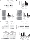 Figure 1. Desmoid cells promote endothelial cell tube formation by activating VEGFR2 in a HIF1A- and CTNNB1-dependent manner. A and B, Effect of CTNNB1 knockdown on (A) HIF1α protein and (B) mRNA expression assessed by dual luciferase assay. C and D, Effect of knockdown of (C) HIF1A or (D) CTNNB1 in DES9525 or DES8163 desmoid cells on co-culture–induced HUVEC tube formation. Representative photos show HUVECs following co-culture with DES9525 cells transduced as indicated; quantitated results average triplicate experiments. E and F, Effect of knockdown of (E) CTNNB1 or (F) HIF1A in desmoid cells on phosphorylation of VEGFR2 in HUVEC cells treated with desmoid-conditioned media for the indicated times; MC indicates nonconditioned media control. G and H, Effect of HIF1α overexpression on (G) HIF1α protein expression and (H) representative trial of co-culture–induced HUVEC tube formation in desmoid cells in which CTNNB1 is knocked down. Control for HIF1α overexpression is red fluorescent protein (RFP, Ctrl; *, P < 0.05).