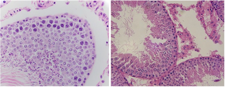 Figure 3 and 4.