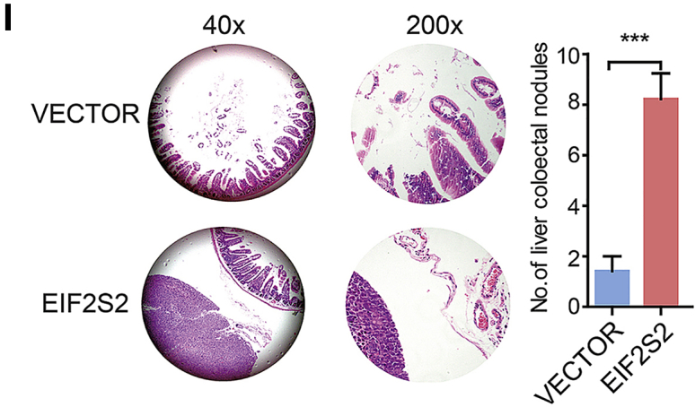 Figure 2I