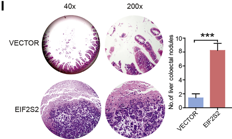 Figure 2I