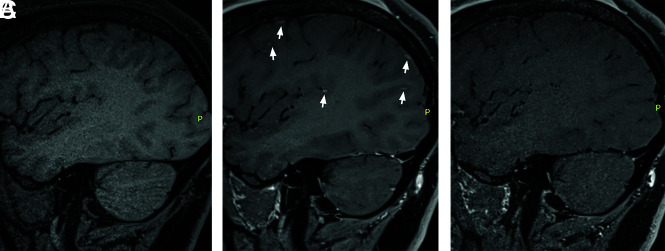 FIG 2.