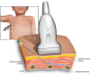 Fig. 4