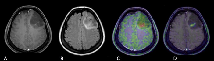 Figure 4. Case 1