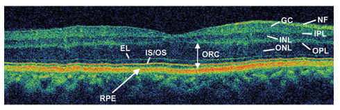 Fig. 1.