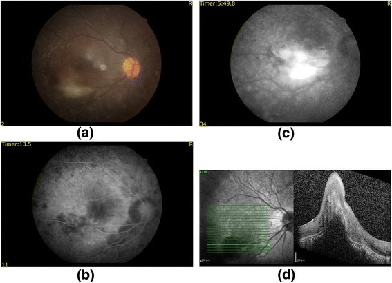 Fig. 4