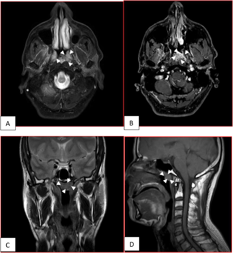 Fig 3: