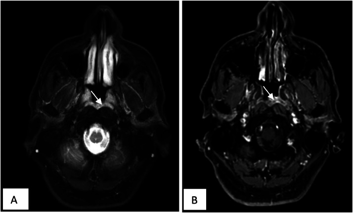 Fig 4: