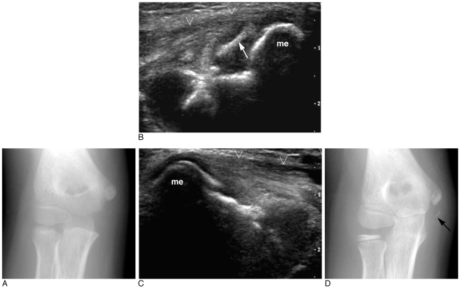 Fig. 5