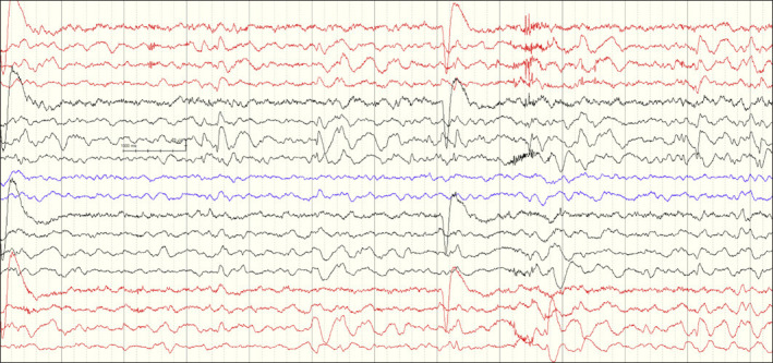 Fig. 1