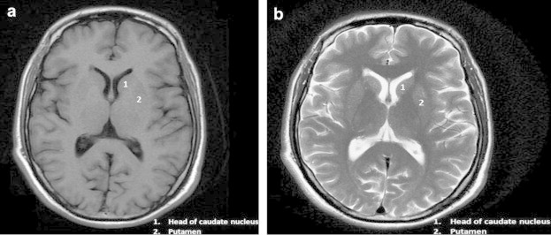 Fig. 2