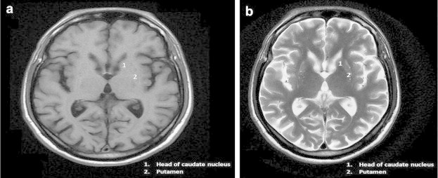 Fig. 1