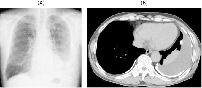 Fig. 1