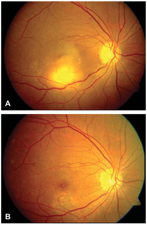 Figure 14