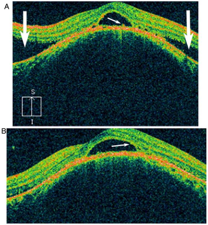 Figure 15