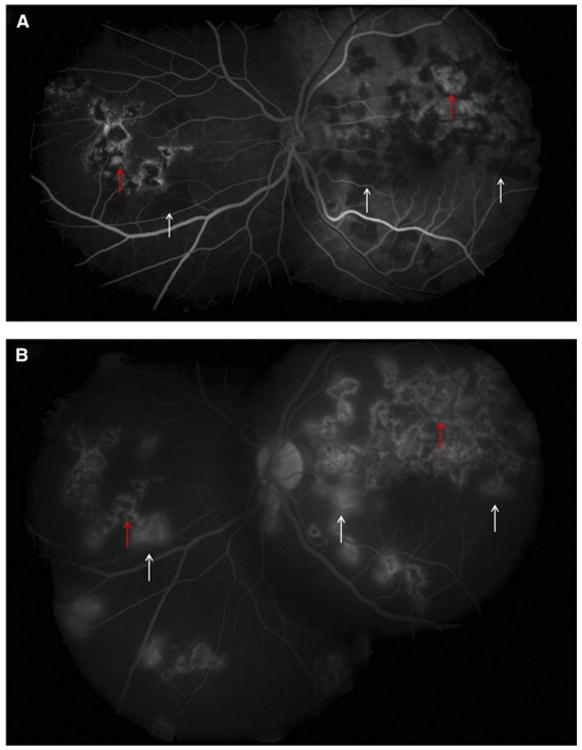 Figure 11