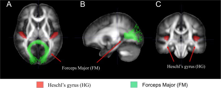 FIGURE 3