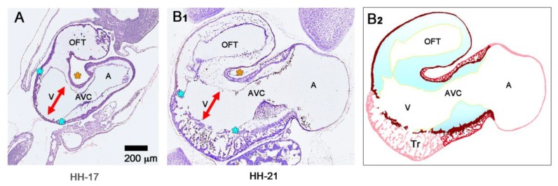 Figure 14