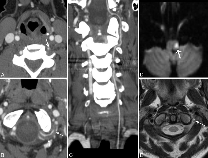 Fig 2.