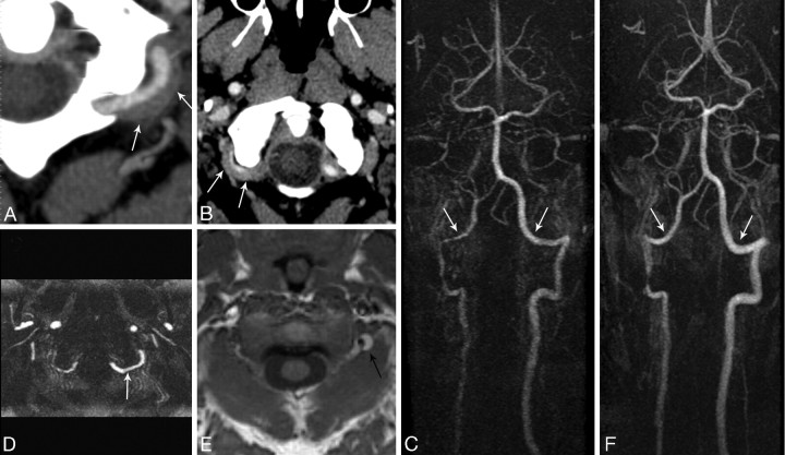 Fig 3.