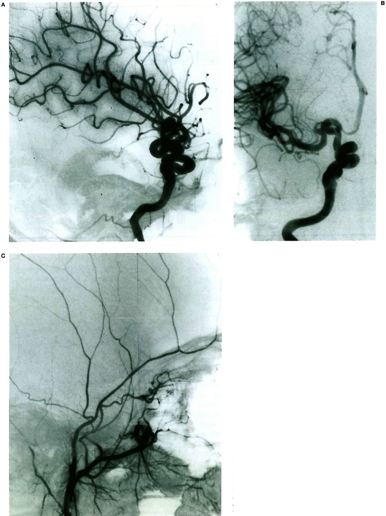 Figure 13