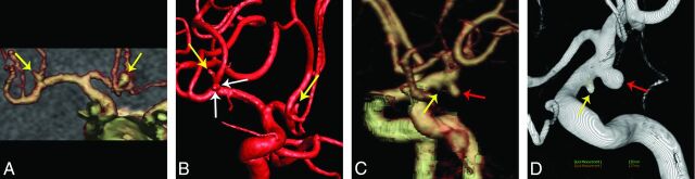 Fig 3.