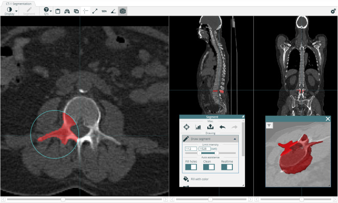 Fig. 3