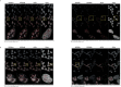 Figure 5—figure supplement 2.