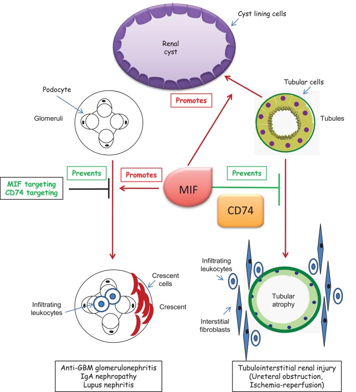 CD74 in Kidney Disease - PMC