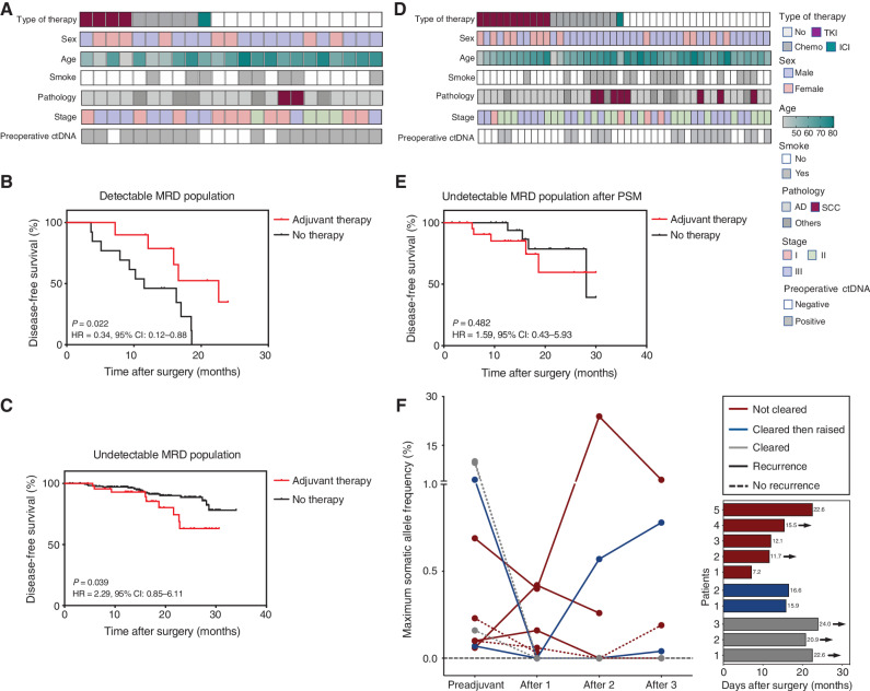 Figure 5. MRD predictive value on adjuvant therapy. A, Heatmap plot based on baseline characteristics of patients with detectable MRD at preadjuvant and landmark timepoints (n = 23). B, Kaplan–Meier analysis of DFS stratified by adjuvant therapy for patients with detectable MRD at preadjuvant and landmark timepoints: with adjuvant therapy (n = 10) versus without (n = 13). C, Kaplan–Meier analysis of DFS stratified by adjuvant therapy for patients with undetectable MRD at preadjuvant and landmark timepoints: with adjuvant therapy (n = 44) versus without (n = 182). D, Heatmap plot based on baseline characteristics of patients with undetectable MRD at preadjuvant and landmark timepoints after propensity score matching (PSM). E, After PSM, Kaplan–Meier analysis of DFS stratified by adjuvant therapy for patients with undetectable MRD at preadjuvant and landmark timepoints: with adjuvant therapy (n = 22) versus without (n = 22). F, Dynamic changes of ctDNA frequency before and after adjuvant therapy for patients with detectable MRD (n = 10), and the DFS of these patients. The arrow represents five of them still maintained disease-free status. TKI, tyrosine kinase inhibitor; Chemo, chemotherapy; ICI, immune-checkpoint inhibitor; AD, adenocarcinoma; SCC, squamous cell carcinoma; DFS, disease-free survival.