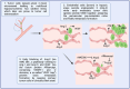 Figure 1: Concept of brain metastasis formation and therapeutic
prevention