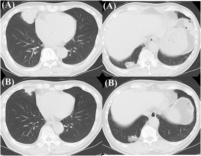 Fig. 5