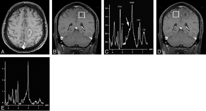 Fig 1.