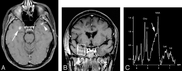 Fig 4.