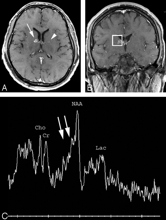 Fig 2.