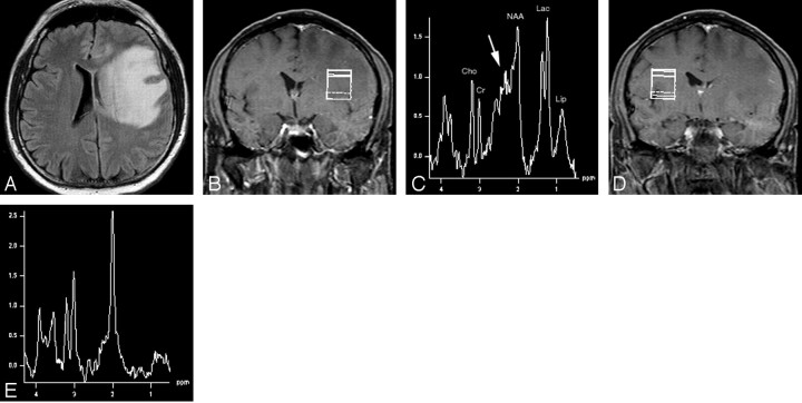 Fig 3.